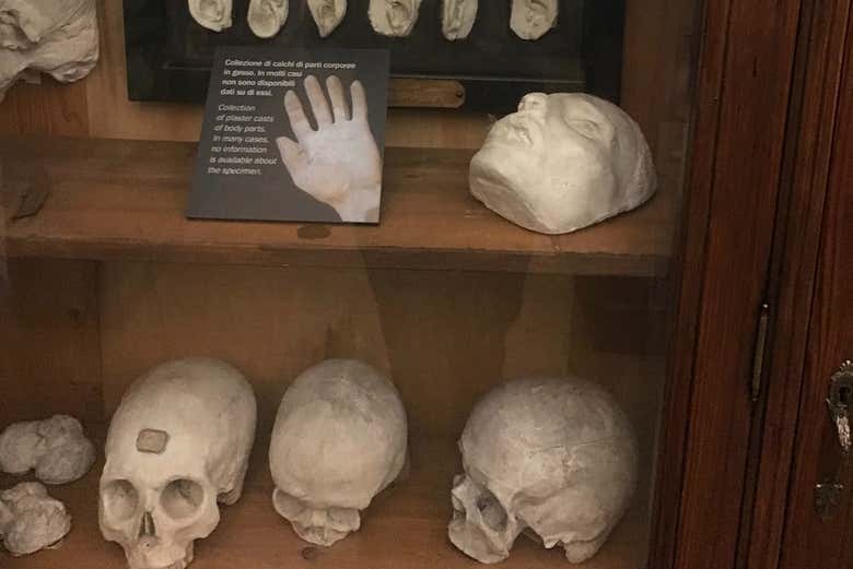 Collezione di parti corporee in gesso