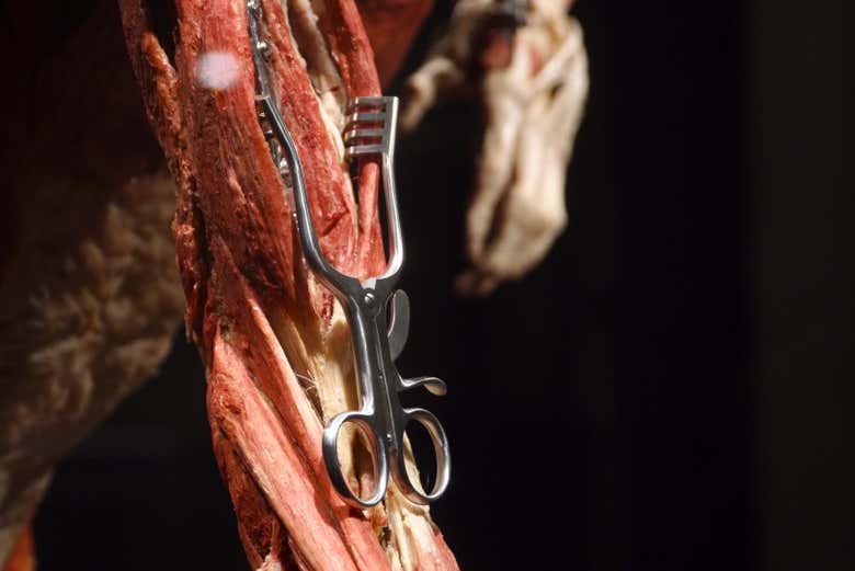Um dos exemplos que poderemos ver no Body Worlds